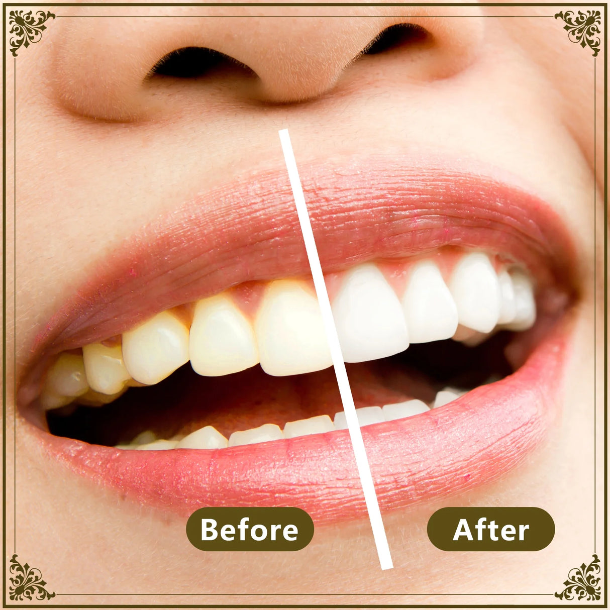 FREEGRIN 6 Pack Natural Miswak Sticks, Organic Wooden Miswak Toothbrush for Healthy Gums & Fresher Breath, No Toothpaste Required, Original Flavor